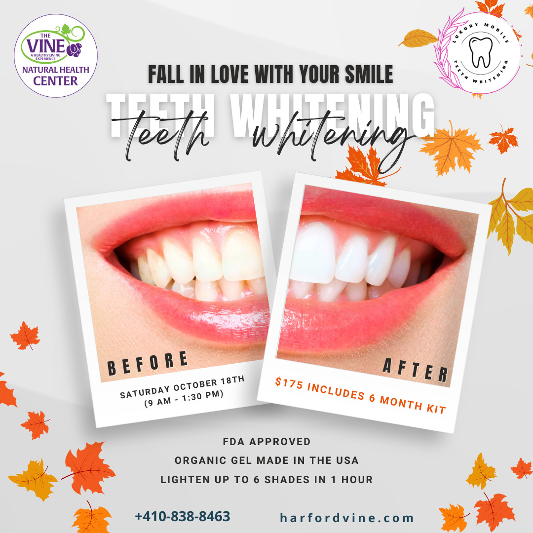 Fall In Love With Your Smile: Teeth Whitening